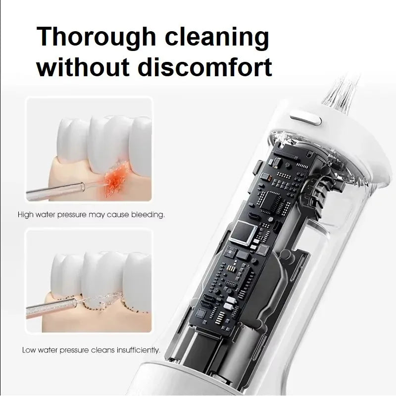 Xiaomi Mijia Oral Irrigator 2 – 200ml, 3 Modes, USB-C, 2 Tips